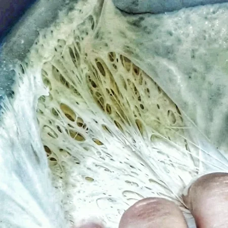 La maglia glutinica